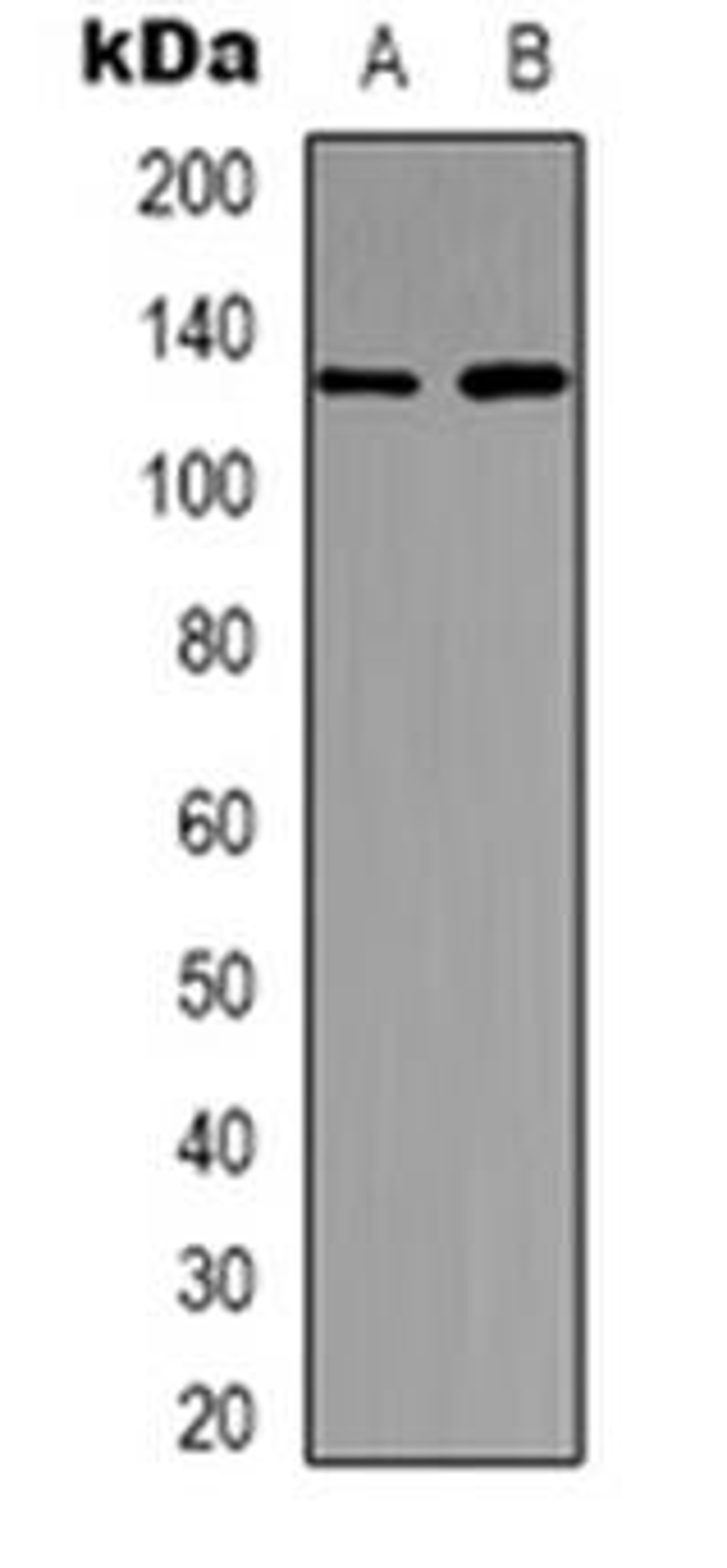 Western blot analysis of USP36 expression in MDCK (Lane 1), K562 (Lane 2) whole cell lysates using USP36 antibody