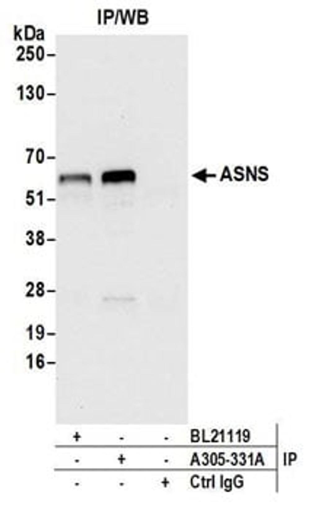 Detection of human ASNS by western blot of immunoprecipitates.