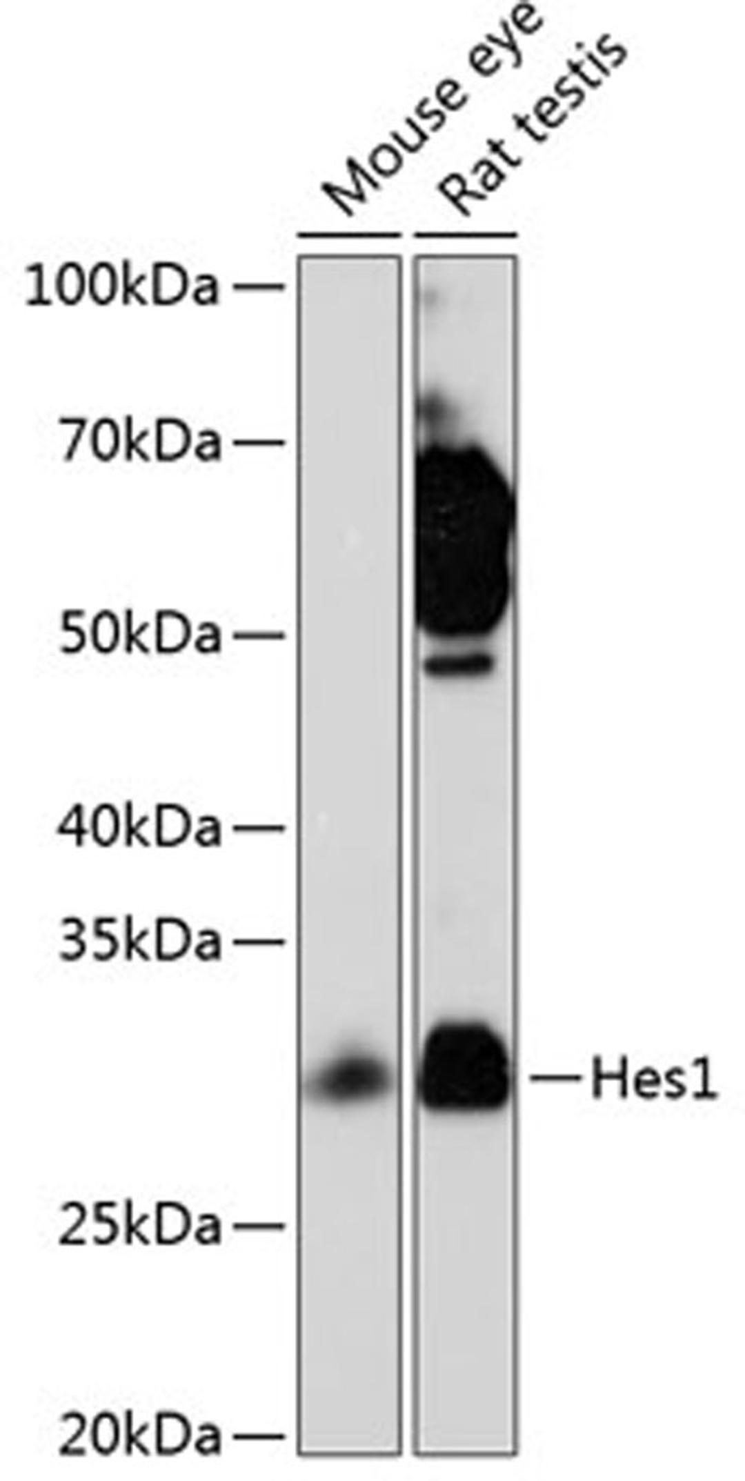 Western blot - Hes1 Rabbit mAb (A0925)