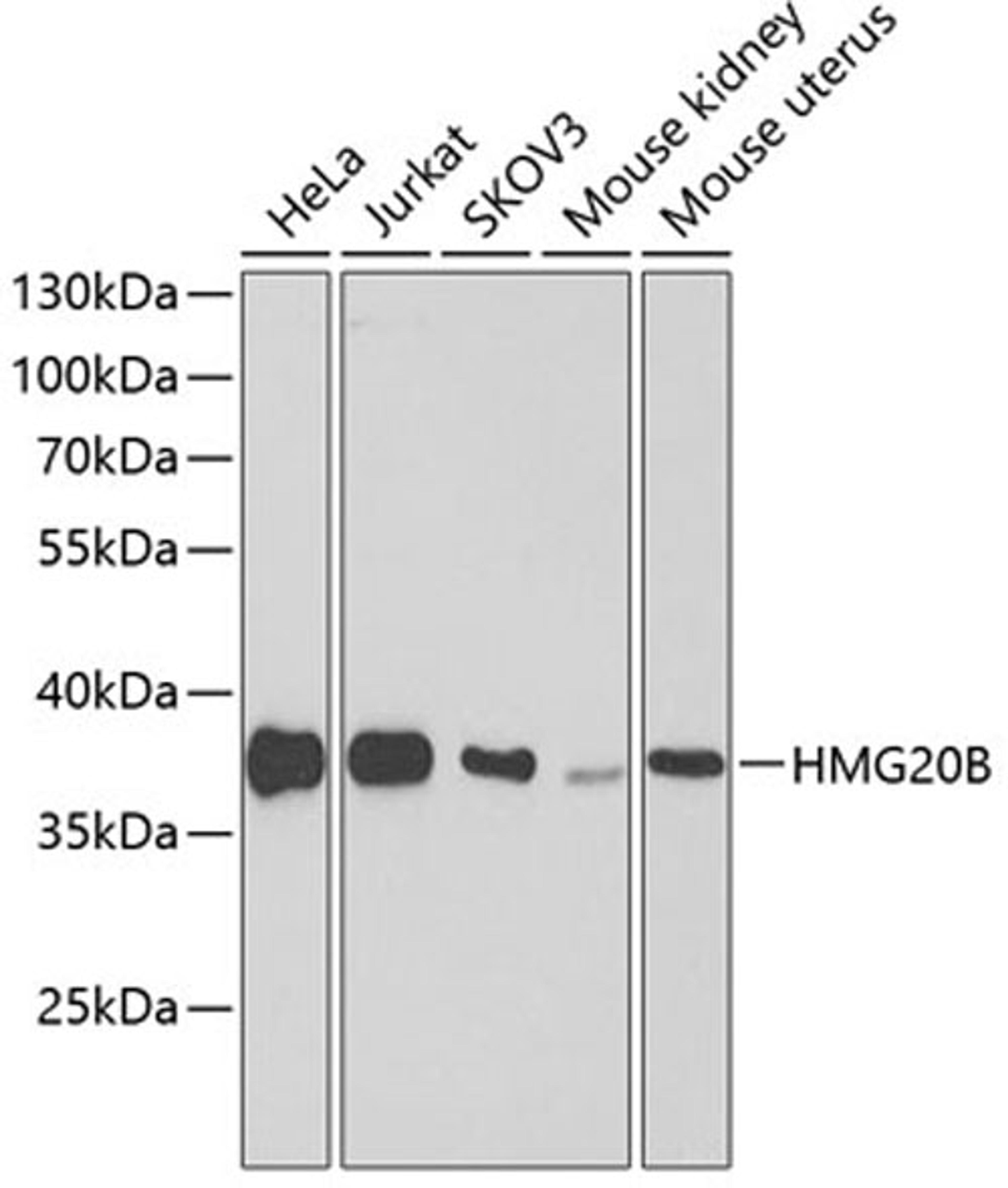 Western blot - HMG20B antibody (A4408)