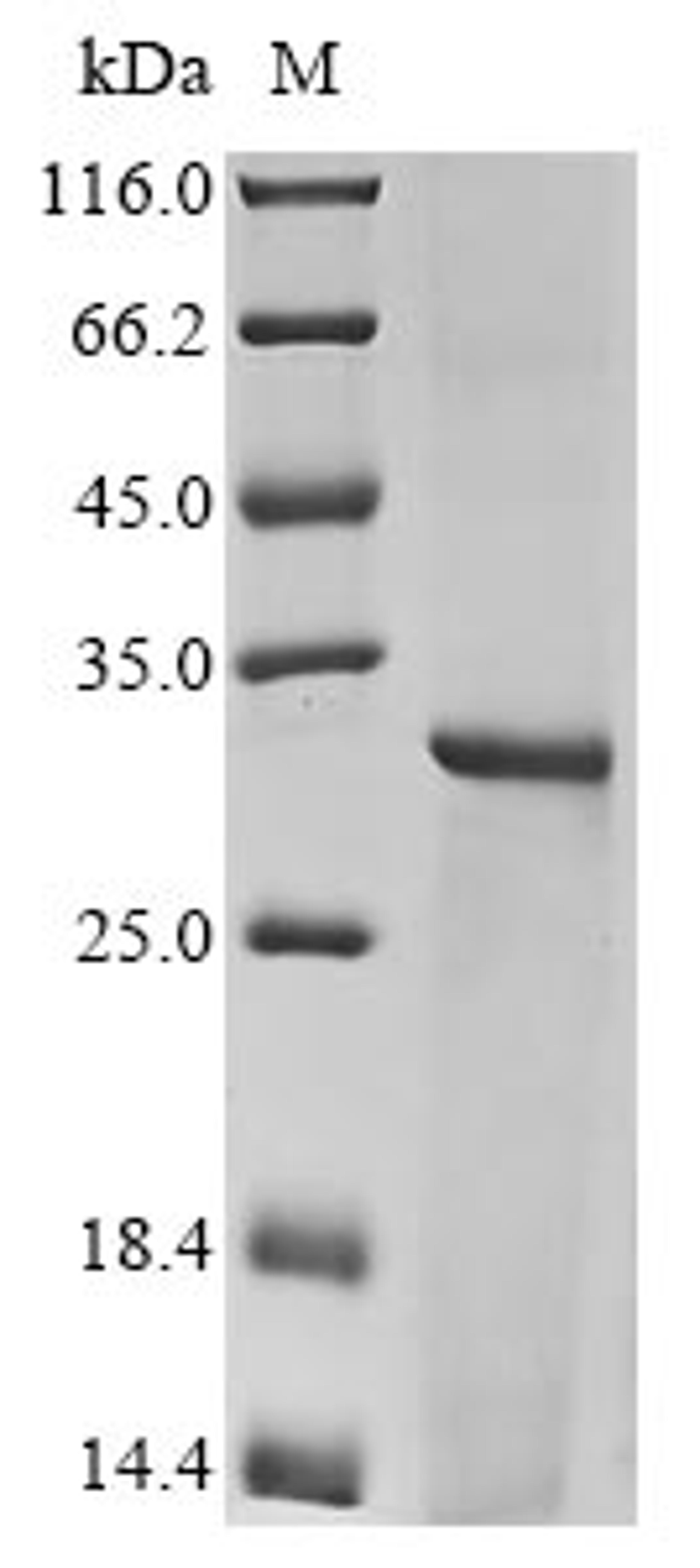 (Tris-Glycine gel) Discontinuous SDS-PAGE (reduced) with 5% enrichment gel and 15% separation gel.