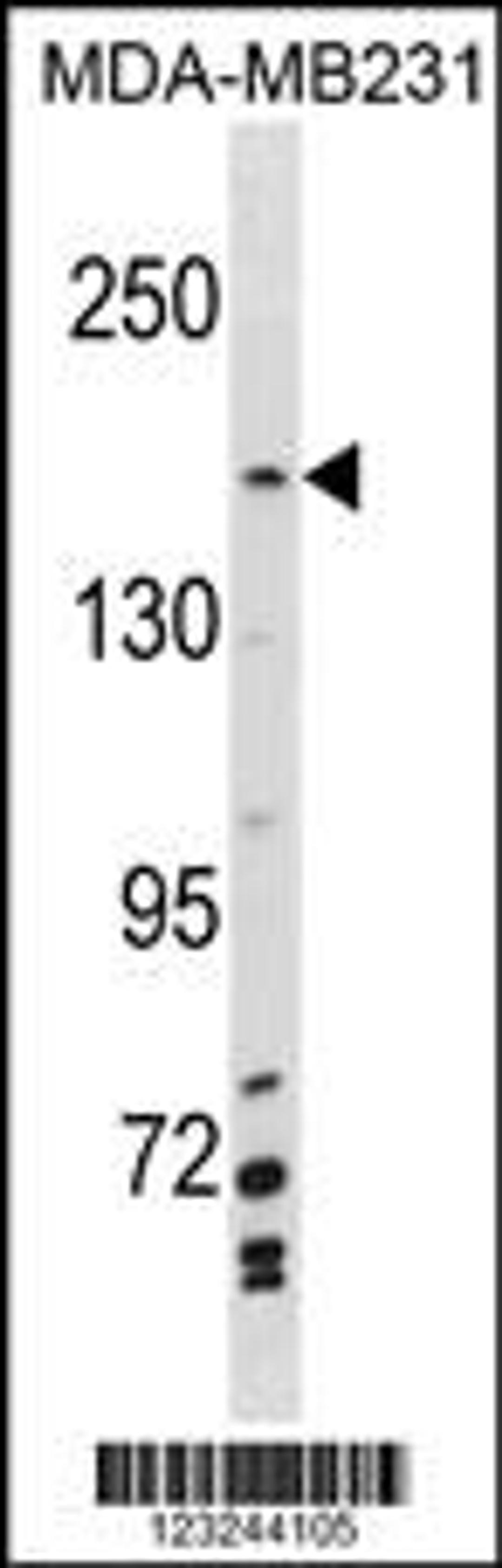 Western blot analysis in MDA-MB231 cell line lysates (35ug/lane).