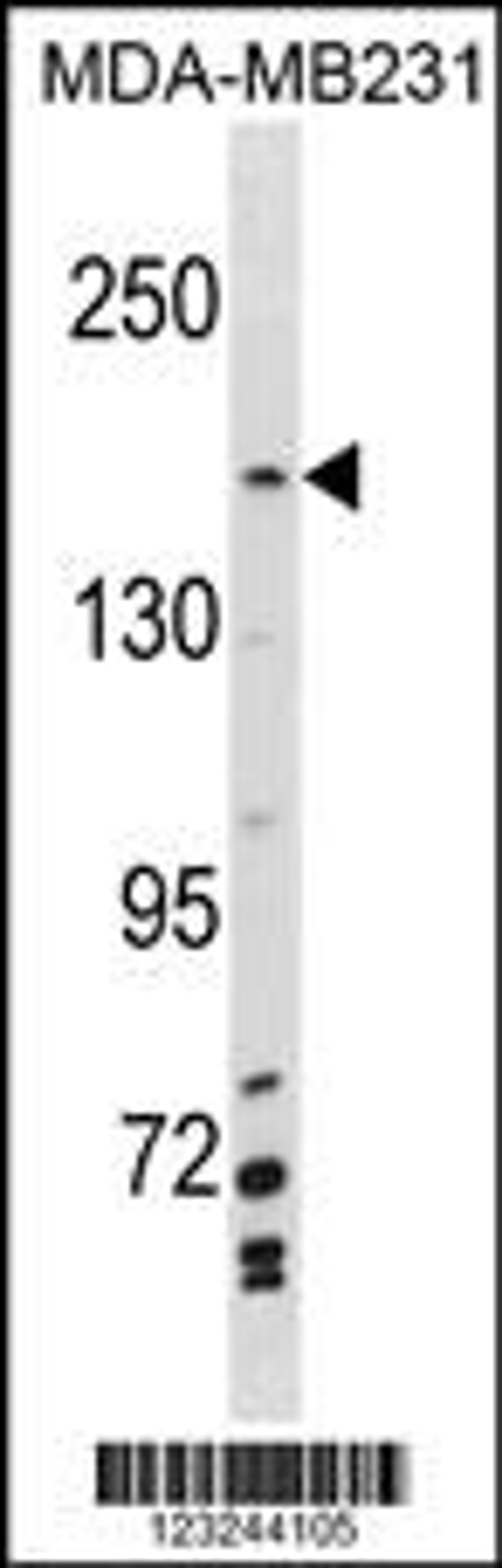 Western blot analysis in MDA-MB231 cell line lysates (35ug/lane).