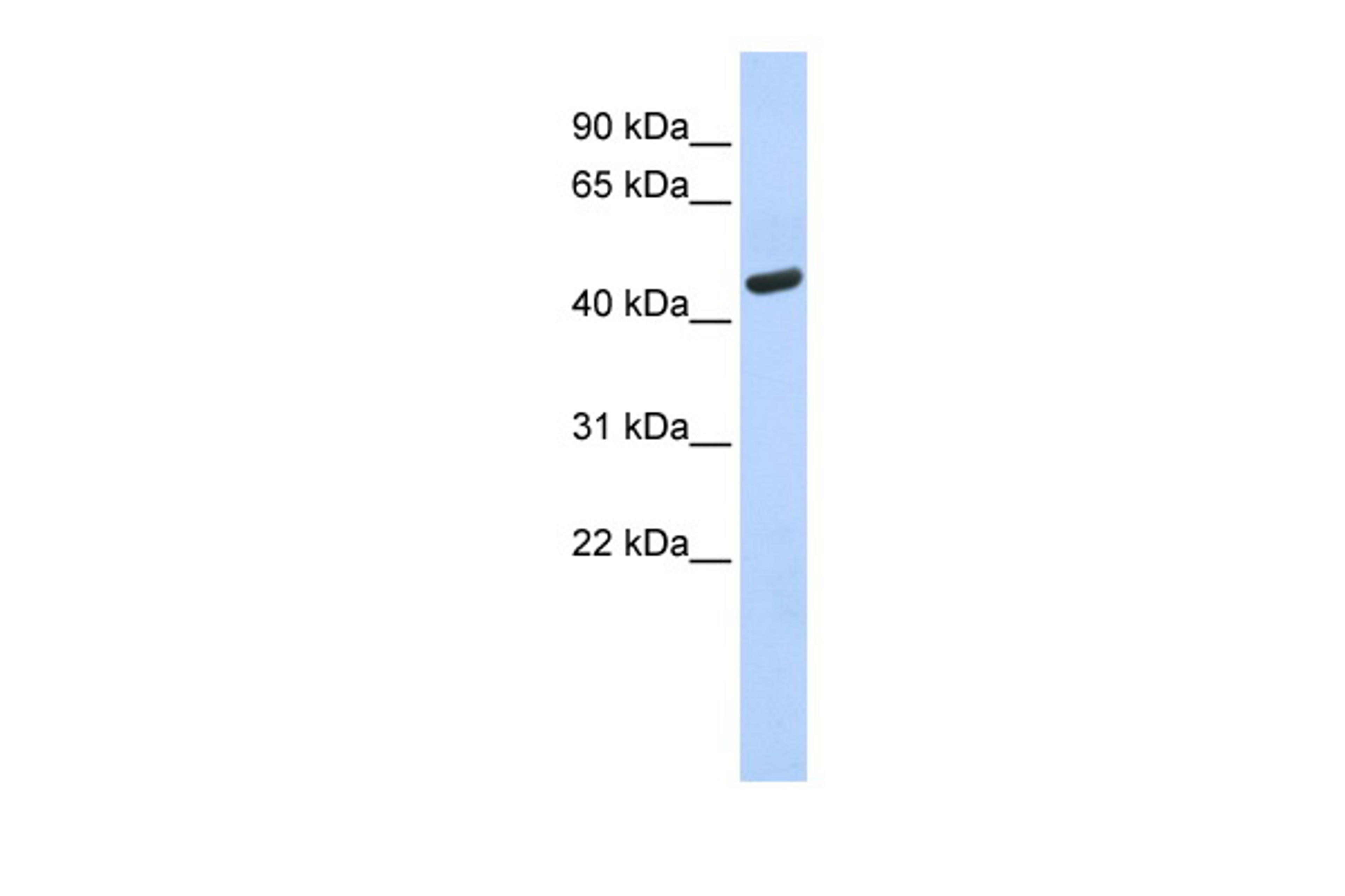 Antibody used in WB on Human Brain at 0.2-1 ug/ml.