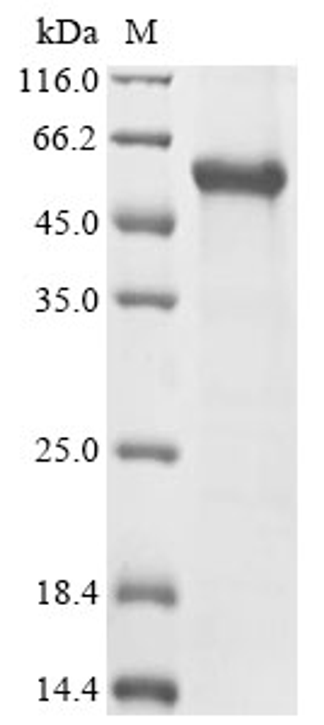(Tris-Glycine gel) Discontinuous SDS-PAGE (reduced) with 5% enrichment gel and 15% separation gel.
