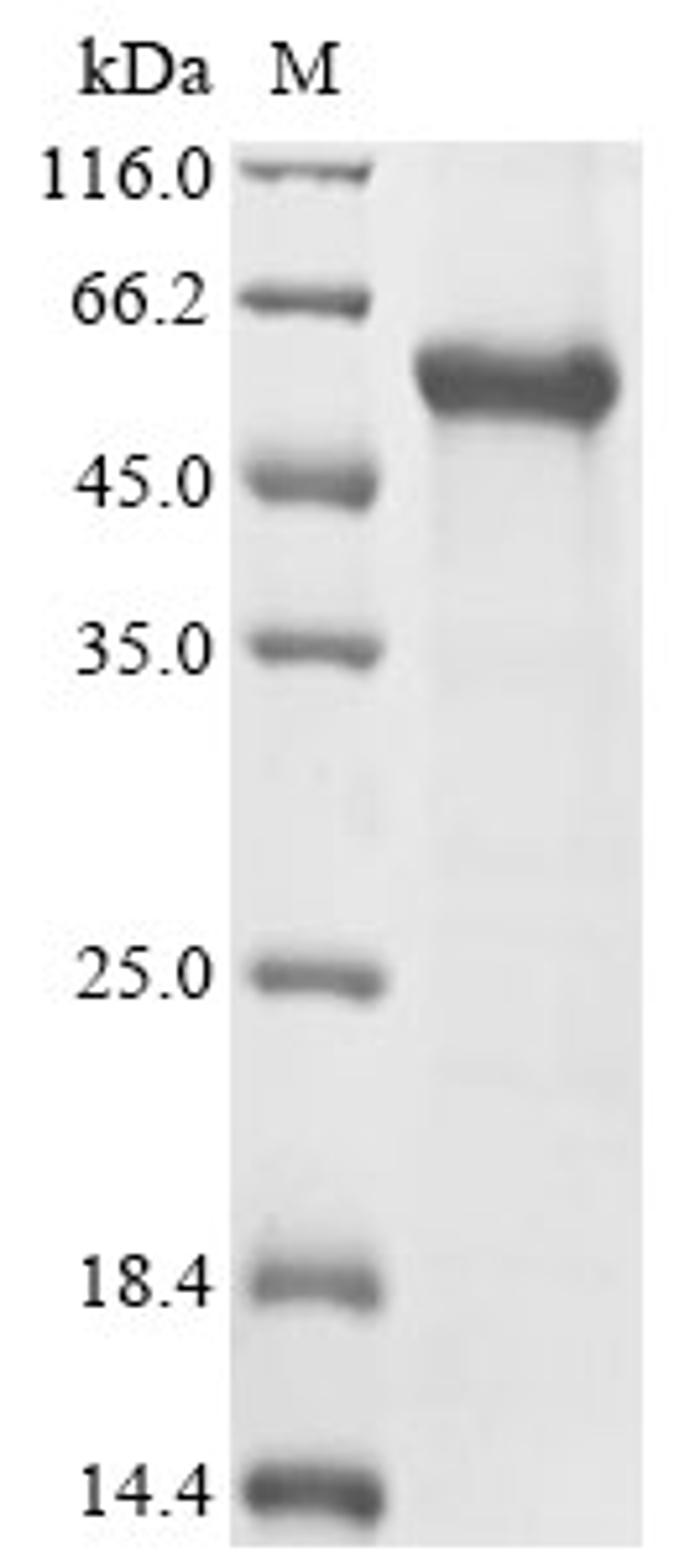 (Tris-Glycine gel) Discontinuous SDS-PAGE (reduced) with 5% enrichment gel and 15% separation gel.