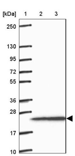 Western Blot: GFPT2 Antibody [NBP2-38881] - Lane 1: Marker [kDa] 250, 130, 95, 72, 55, 36, 28, 17, 10<br/>Lane 2: RT-4<br/>Lane 3: U-251 MG