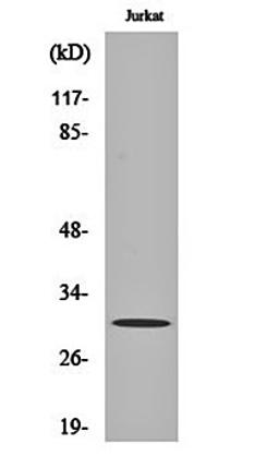 Western blot analysis of Jurkat cell lysates using ATF-5 antibody