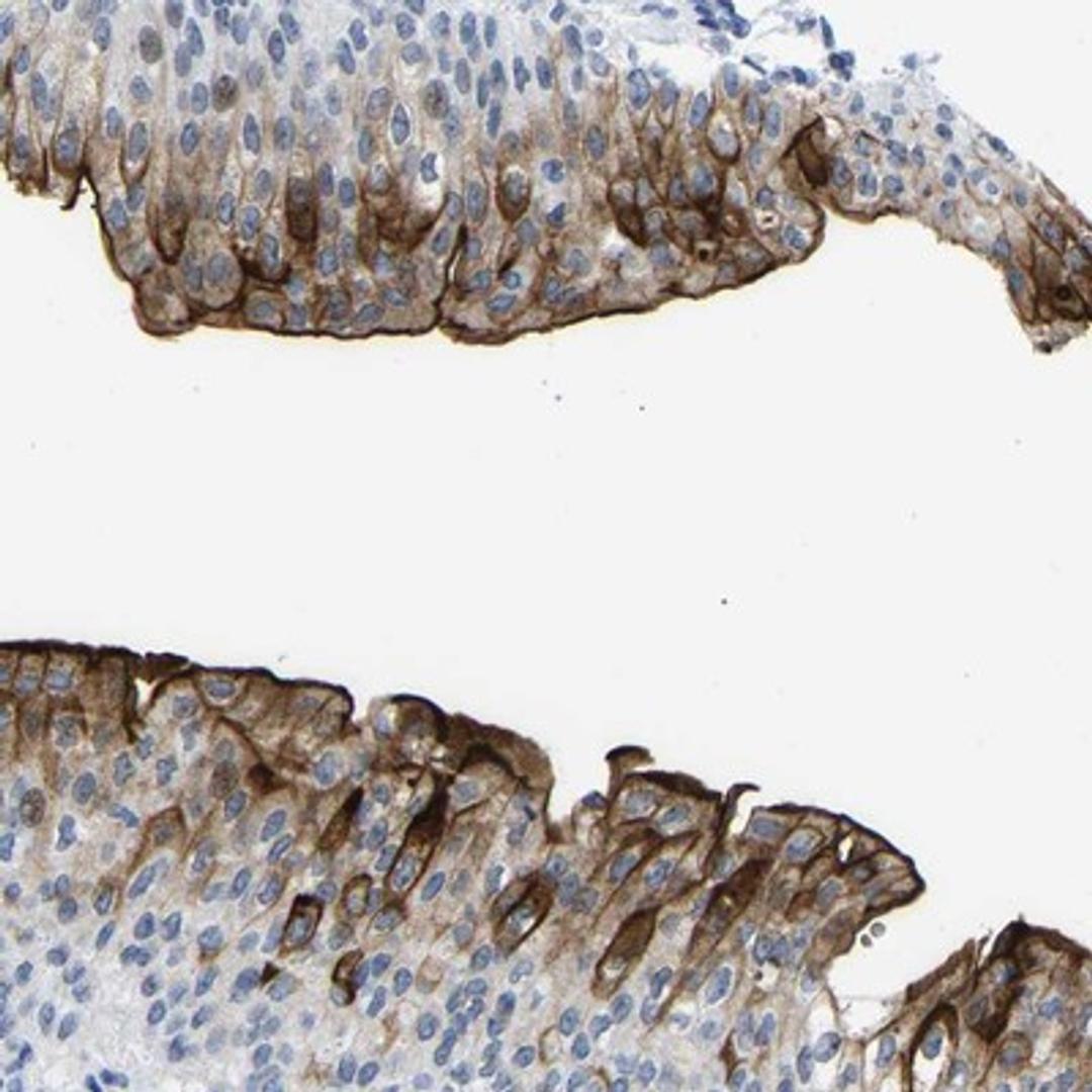 Immunohistochemistry-Paraffin: Uroplakin III Antibody [NBP1-86873] - Staining of human urinary bladder shows strong cytoplasmic and membranous positivity in urothelial cells.