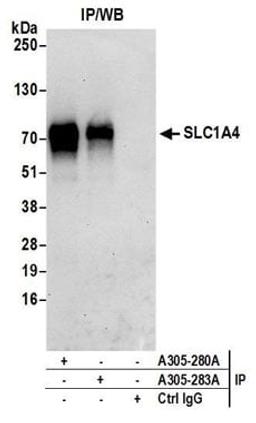 Detection of human SLC1A4 by western blot of immunoprecipitates.