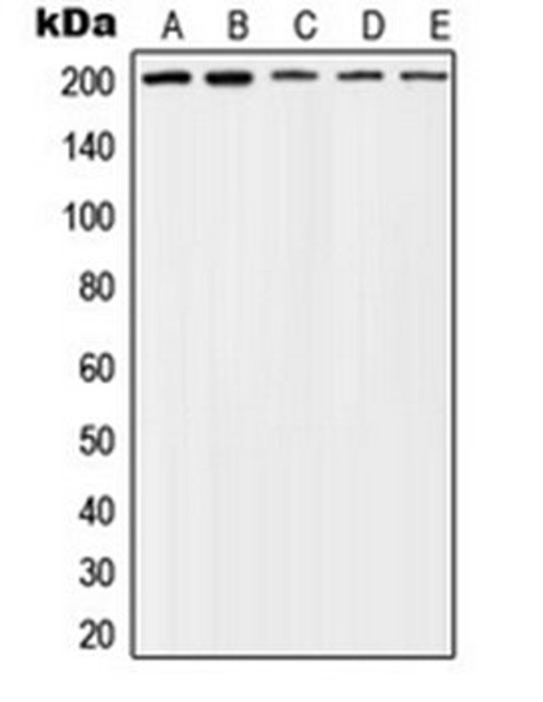 Western blot analysis of SHSY5Y (Lane 1), PC3 (Lane 2), LNCaP (Lane 3), NIH3T3 (Lane 4), PC12 (Lane 5) whole cell lysates using TSC2 (phospho-T1462) antibody