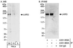 Detection of human LARG by western blot and immunoprecipitation.