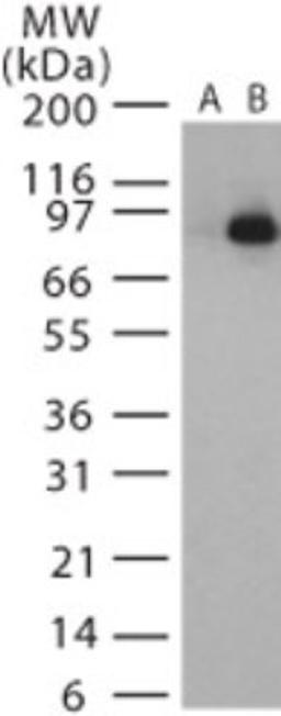 Western Blot: Anthrax LF Antibody [NB100-56666] - analysis of Anthrax LF in recombinant protein using this antibody. Lane A shows the pre-bleed.