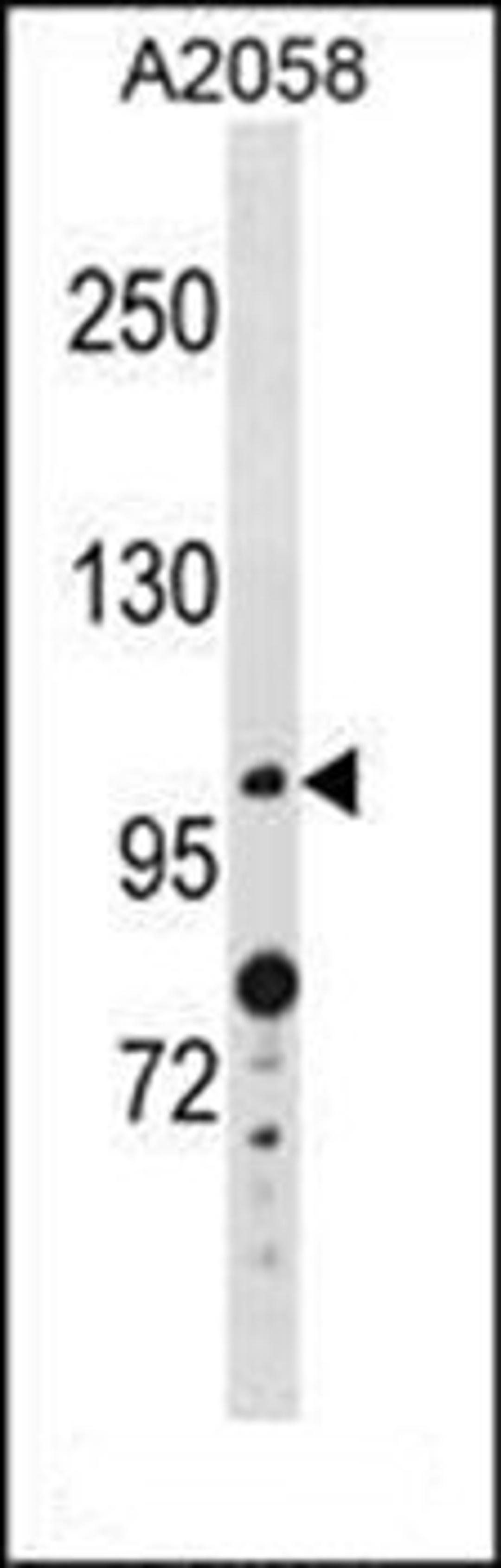 Western blot analysis of A2058 cell line lysates (35ug/lane) using ANO4 antibody (N-term)