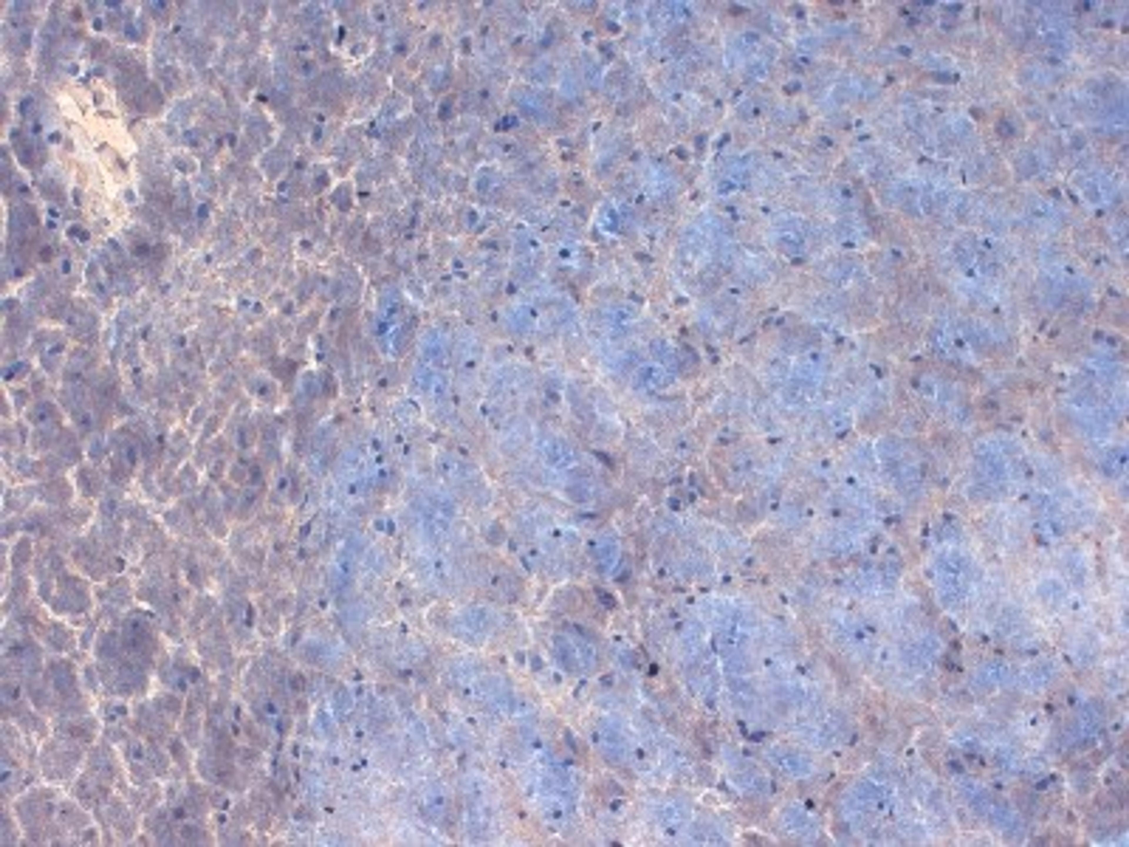 Immunohistochemistry-Frozen: SCN2A Antibody (S69-3) [NBP1-48248] - mouse brain extract using this antibody.