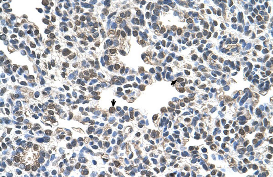 Antibody used in IHC on Human Lung.