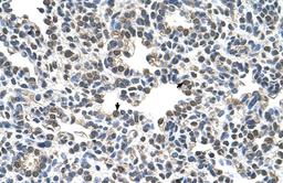 Antibody used in IHC on Human Lung.