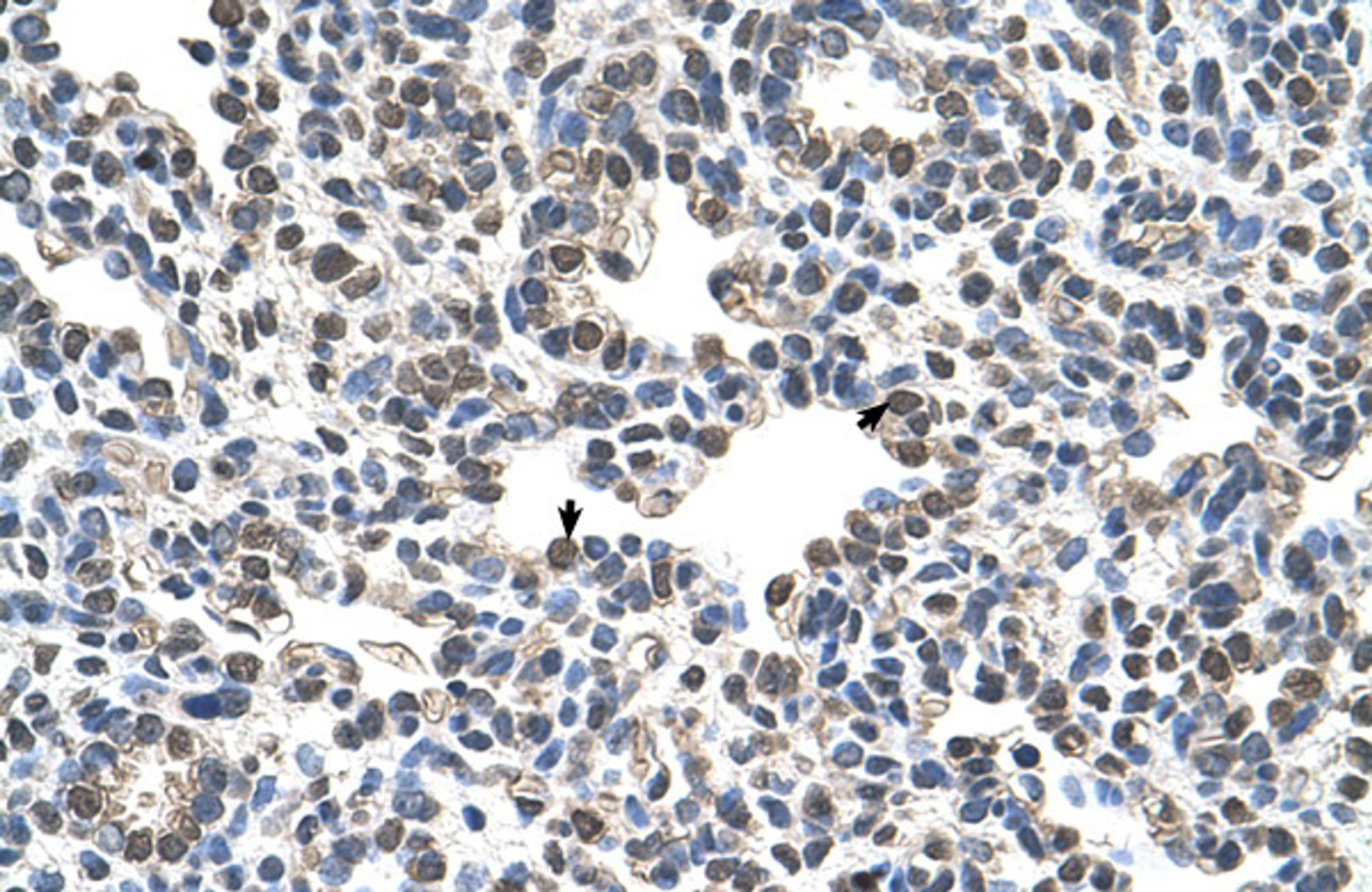 Antibody used in IHC on Human Lung.