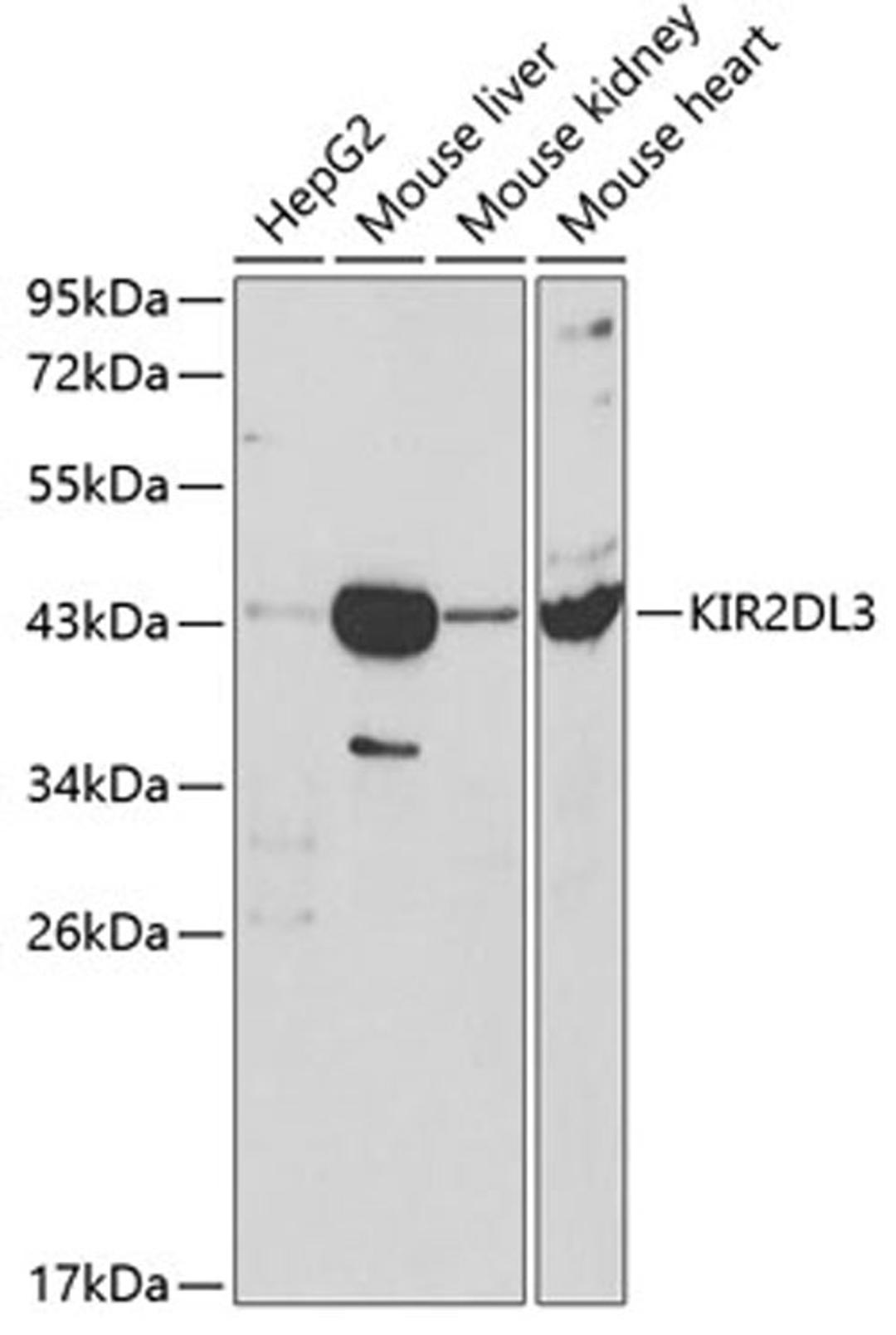 Western blot - KIR2DL3 antibody (A1698)