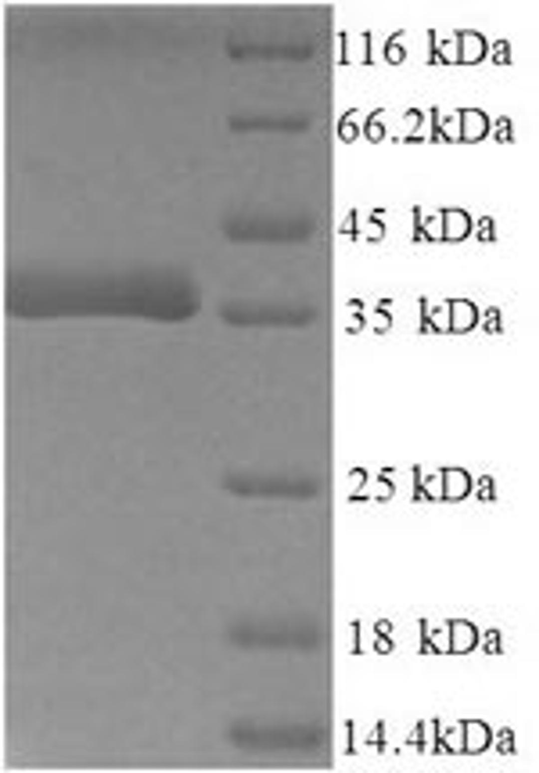 (Tris-Glycine gel) Discontinuous SDS-PAGE (reduced) with 5% enrichment gel and 15% separation gel.