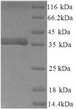 (Tris-Glycine gel) Discontinuous SDS-PAGE (reduced) with 5% enrichment gel and 15% separation gel.