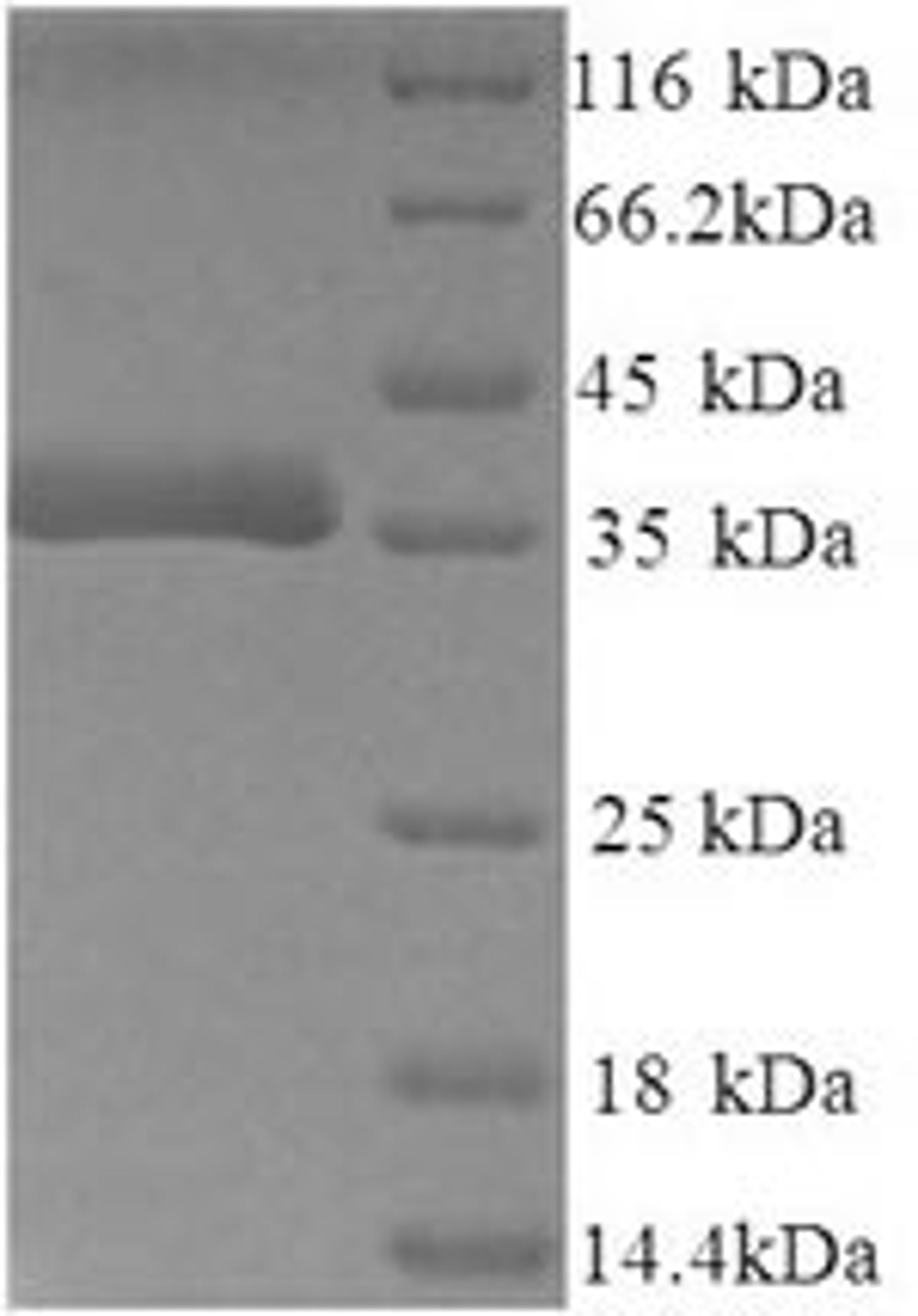 (Tris-Glycine gel) Discontinuous SDS-PAGE (reduced) with 5% enrichment gel and 15% separation gel.