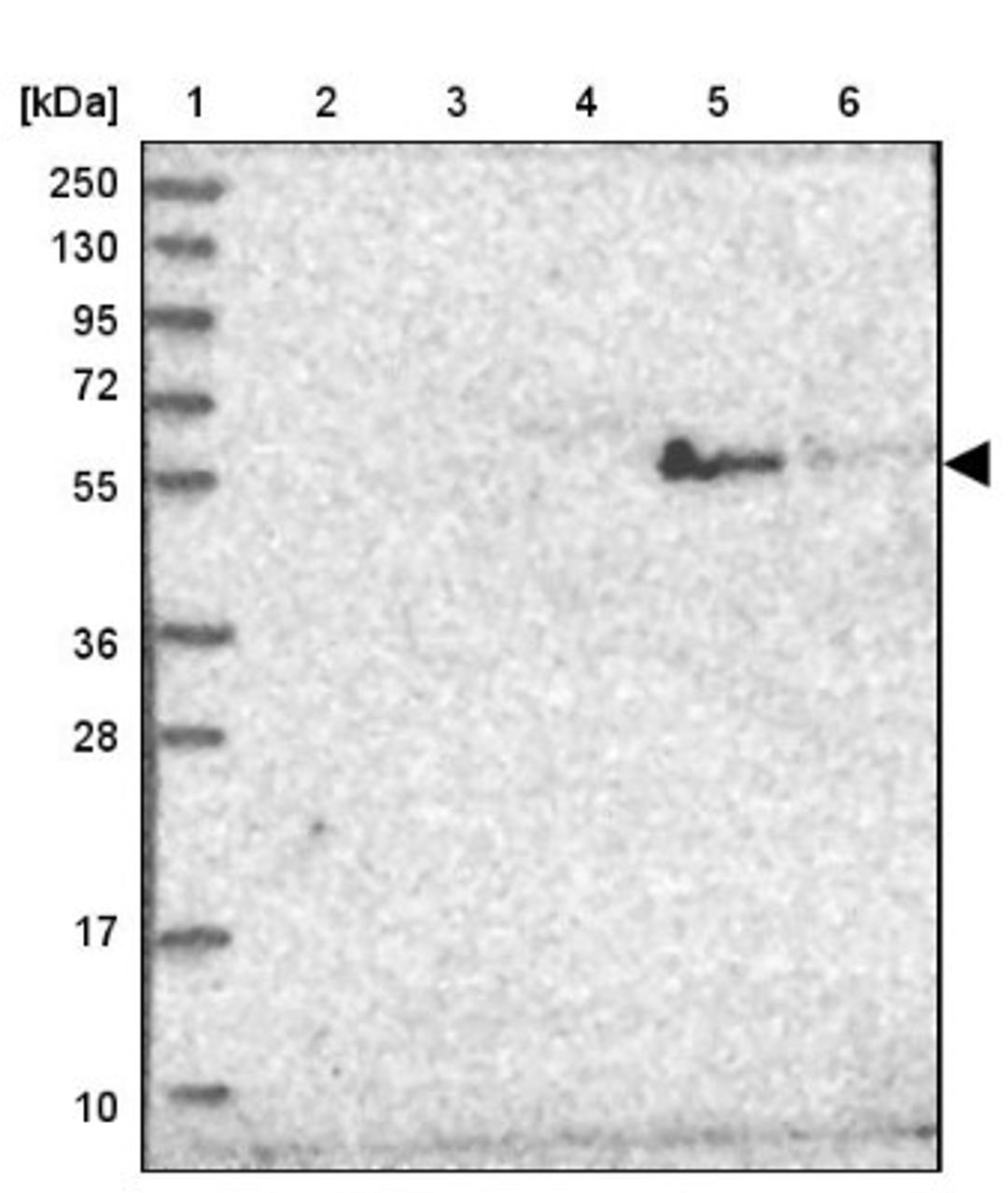 Western Blot: ST3GAL5 Antibody [NBP2-32612] - Lane 1: Marker [kDa] 250, 130, 95, 72, 55, 36, 28, 17, 10<br/>Lane 2: Human cell line RT-4<br/>Lane 3: Human cell line U-251MG sp<br/>Lane 4: Human plasma (IgG/HSA depleted)<br/>Lane 5: Human liver tissue<br/>Lane 6: Human tonsil tissue