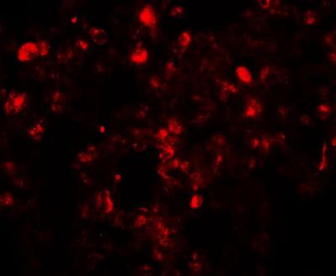 Immunocytochemistry/Immunofluorescence: Translin Antibody [NBP1-76581] - Immunofluorescence of Translin in human lung tissue with Translin antibody at 20 ug/mL.