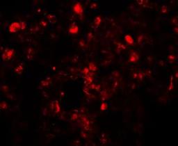 Immunocytochemistry/Immunofluorescence: Translin Antibody [NBP1-76581] - Immunofluorescence of Translin in human lung tissue with Translin antibody at 20 ug/mL.