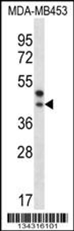 Western blot analysis in MDA-MB453 cell line lysates (35ug/lane).