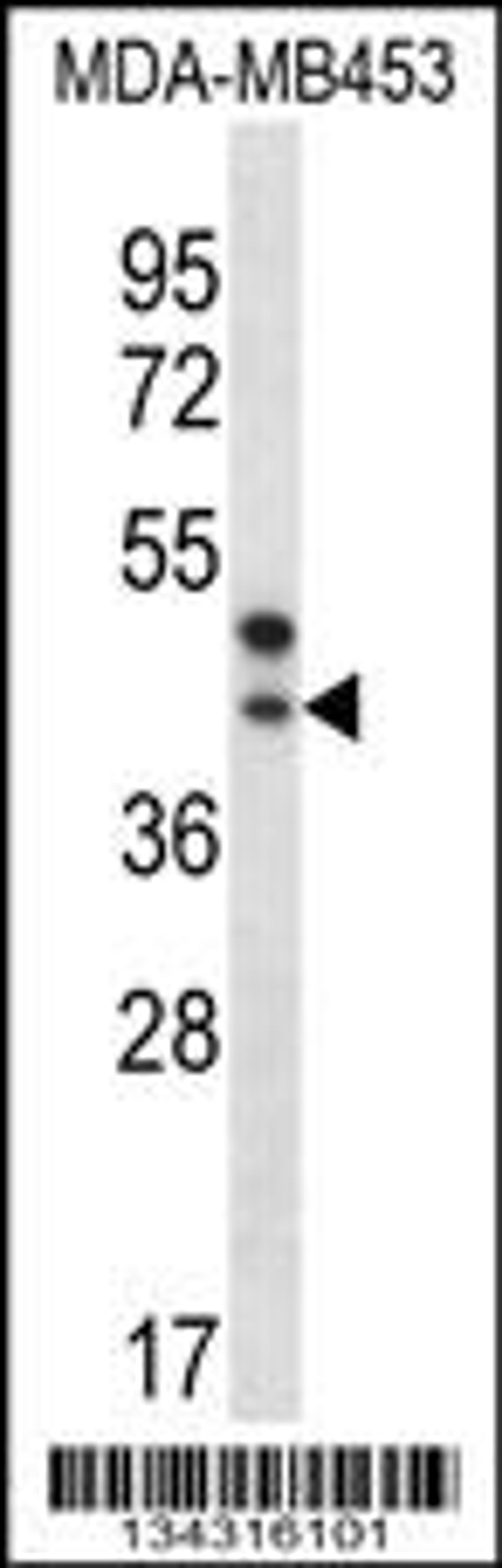 Western blot analysis in MDA-MB453 cell line lysates (35ug/lane).