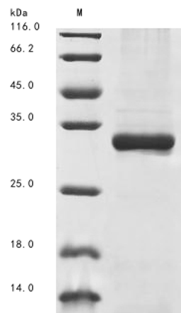 (Tris-Glycine gel) Discontinuous SDS-PAGE (reduced) with 5% enrichment gel and 15% separation gel.