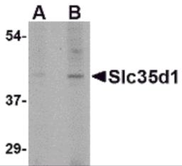 Western blot analysis of Slc35D1 in Daudi lysate with Slc35D1 antibody at (A) 1 and (B) 2 &#956;g/mL.