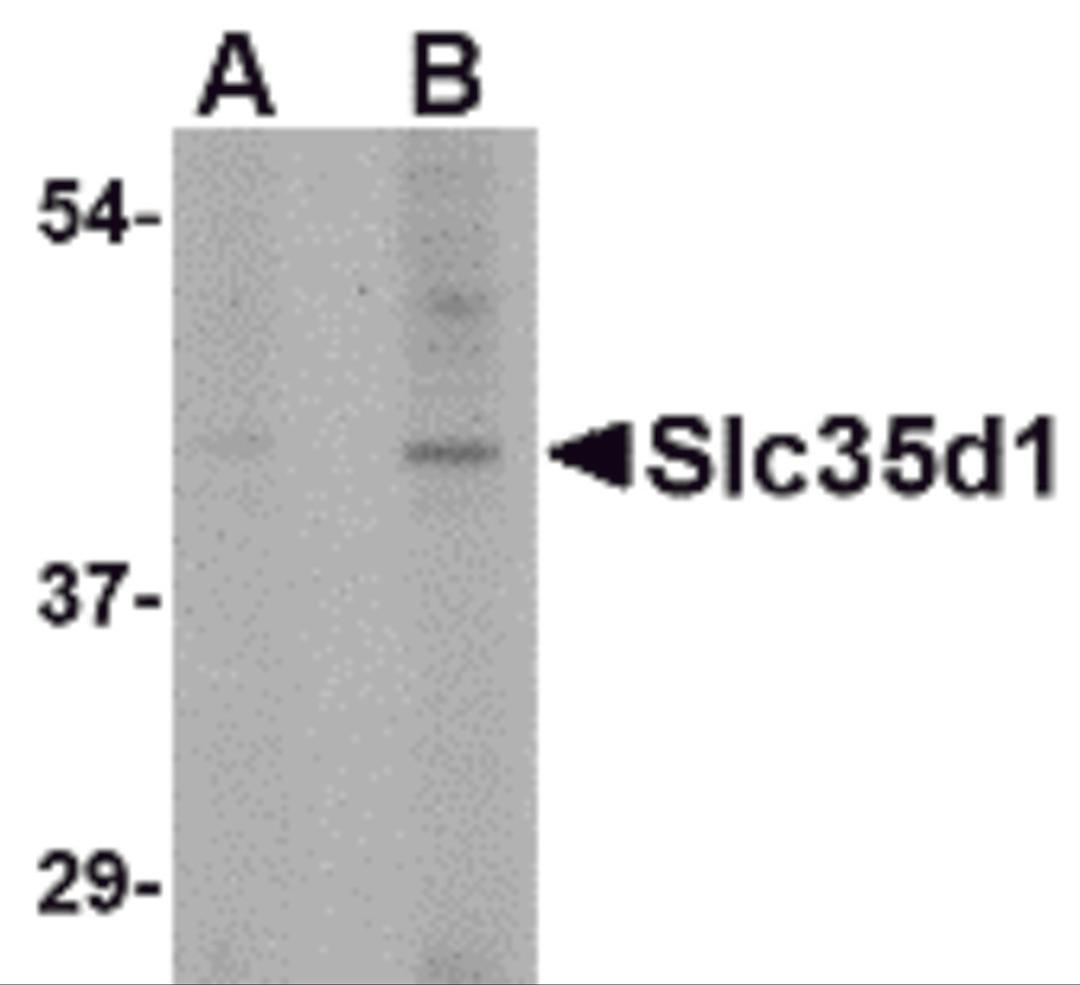 Western blot analysis of Slc35D1 in Daudi lysate with Slc35D1 antibody at (A) 1 and (B) 2 μg/mL.