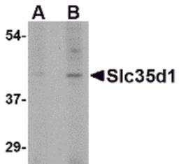 Western blot analysis of Slc35D1 in Daudi lysate with Slc35D1 antibody at (A) 1 and (B) 2 μg/mL.