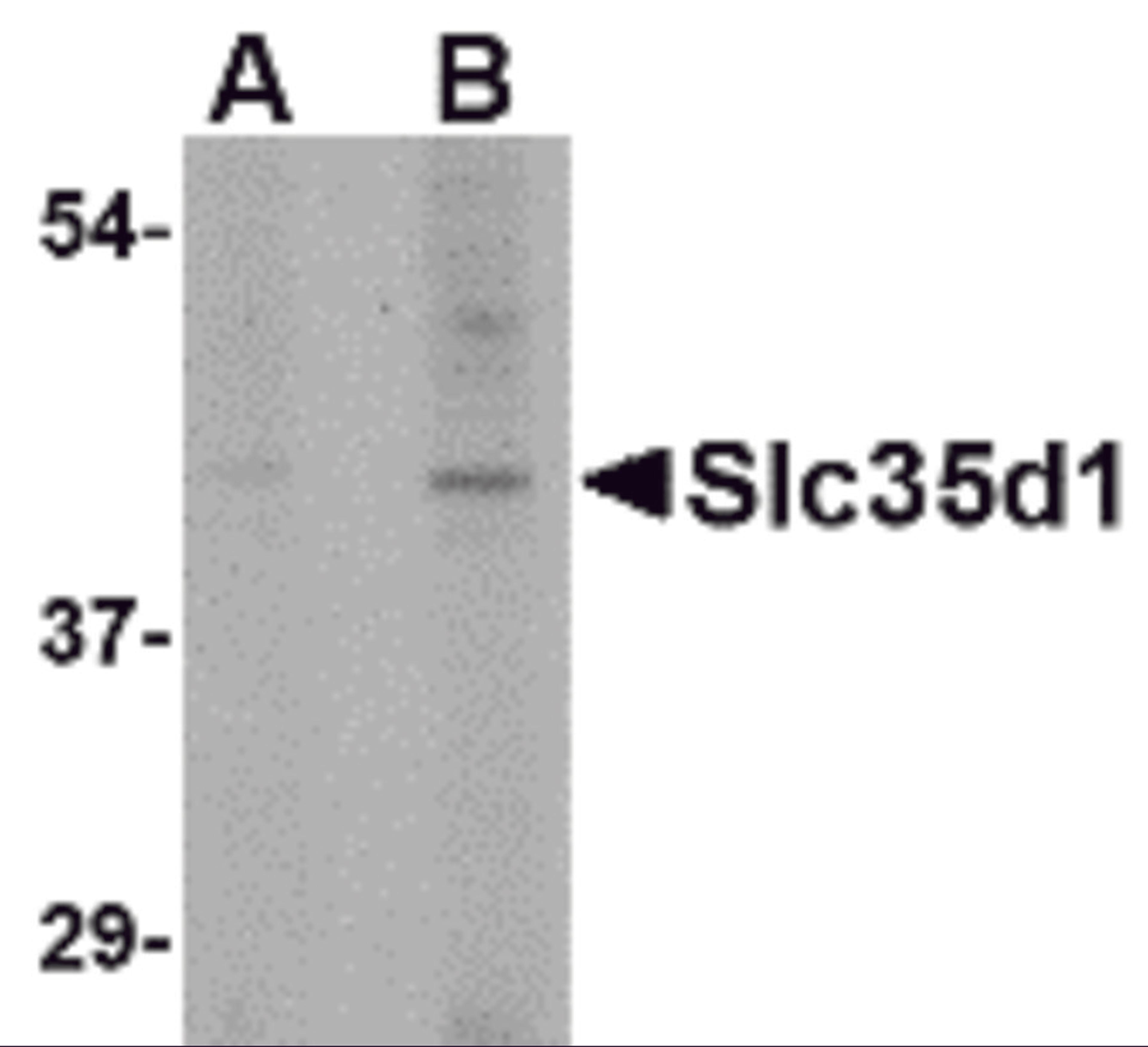 Western blot analysis of Slc35D1 in Daudi lysate with Slc35D1 antibody at (A) 1 and (B) 2 μg/mL.