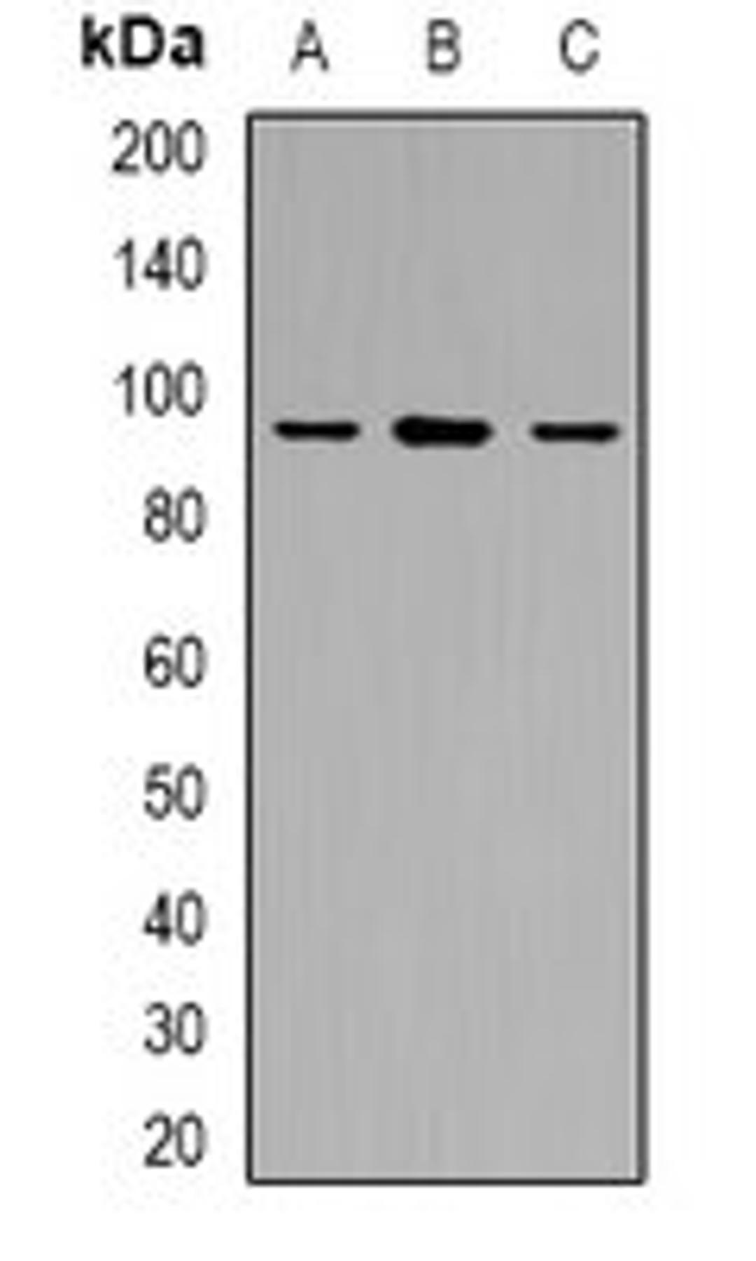 Western blot analysis of Jurkat (Lane1), RAW264.7 (Lane2), PC12 (Lane3) whole cell lysates using USP6NL antibody