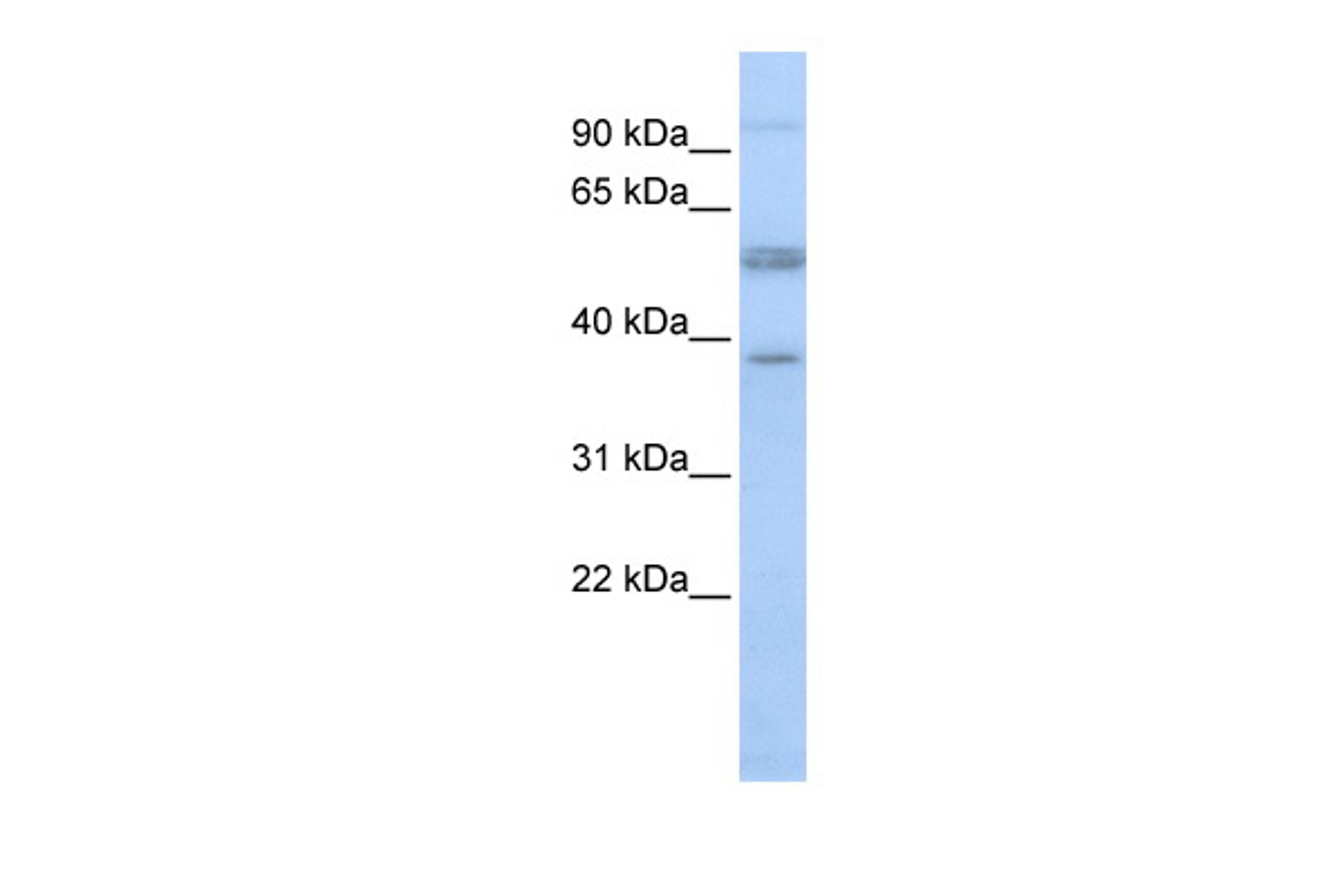 Antibody used in WB on Human OVCAR-3 at 0.2-1 ug/ml.