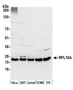 Detection of human and mouse RPL18A by western blot.