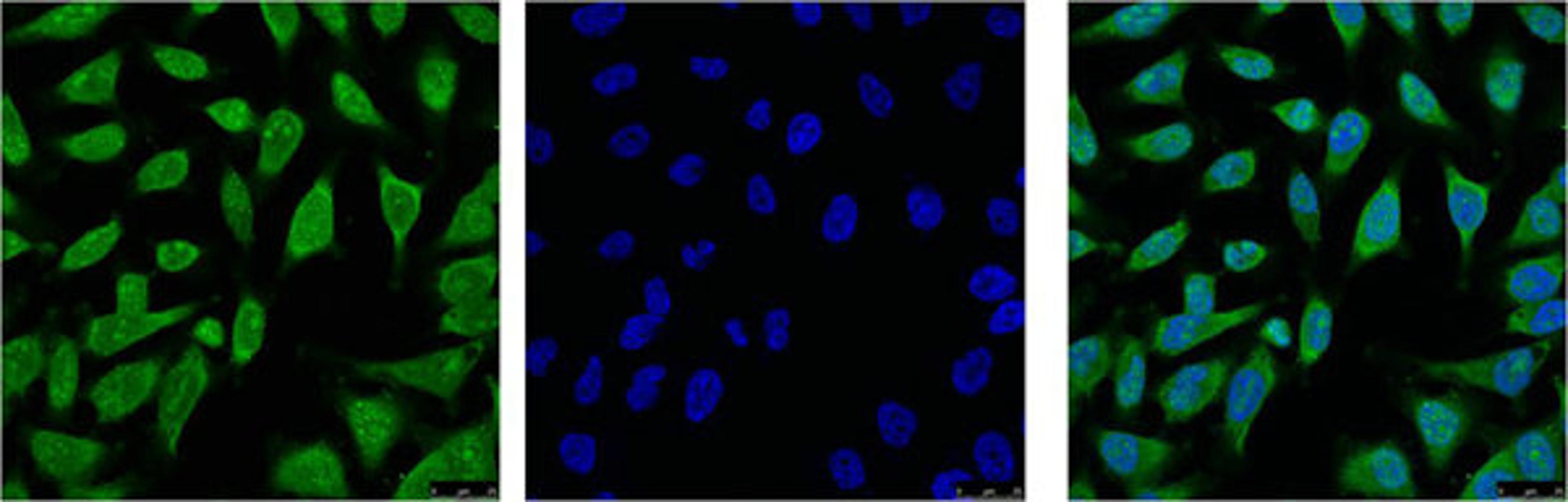IF analysis of Hela with antibody (Left) and DAPI (Right) diluted at 1:100.