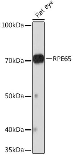 Western blot - RPE65 Rabbit mAb (A9615)