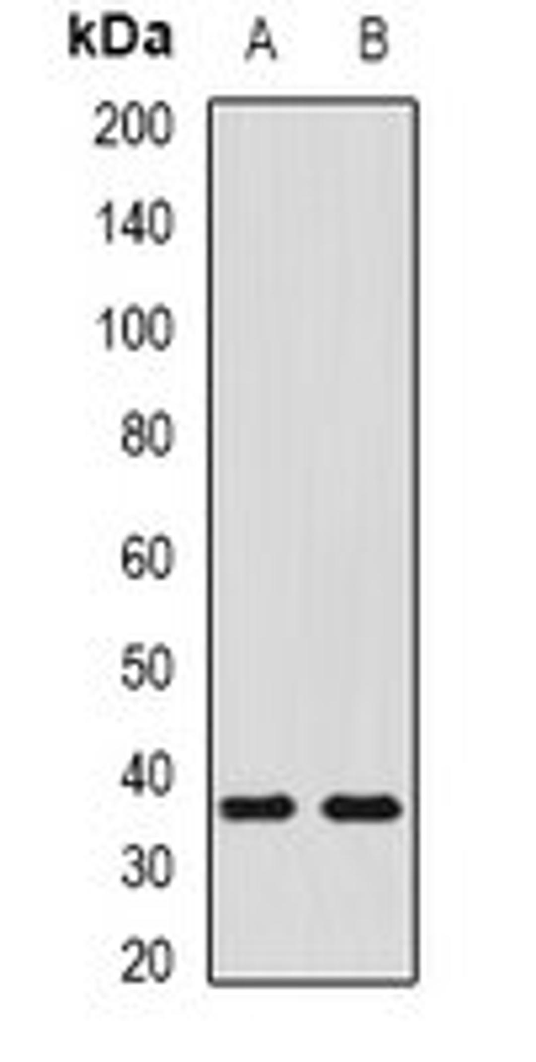 Western blot analysis of NIH3T3 (Lane1), mouse liver (Lane2) whole cell lysates using SHOX2 antibody