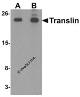 Western blot analysis of Translin in rat lung tissue lysate with Translin antibody at (A) 0.5 and (B) 1 &#956;g/mL