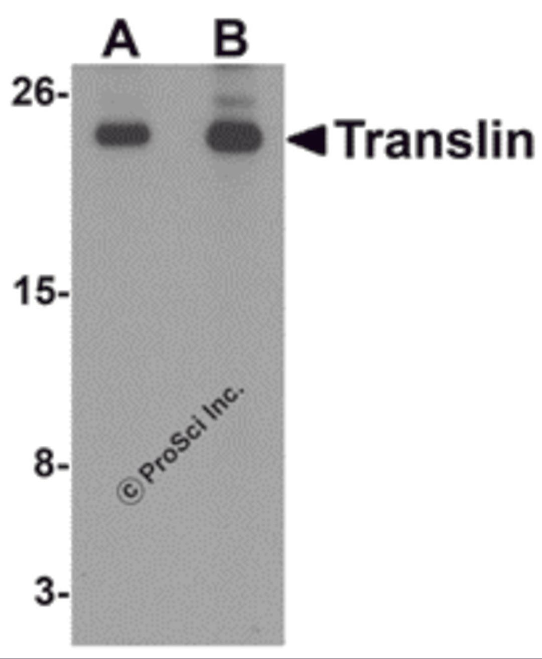 Western blot analysis of Translin in rat lung tissue lysate with Translin antibody at (A) 0.5 and (B) 1 μg/mL