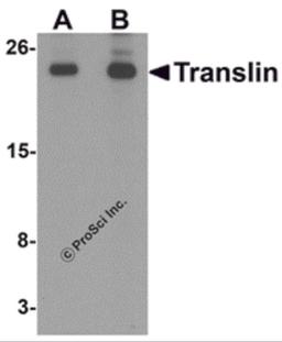 Western blot analysis of Translin in rat lung tissue lysate with Translin antibody at (A) 0.5 and (B) 1 μg/mL