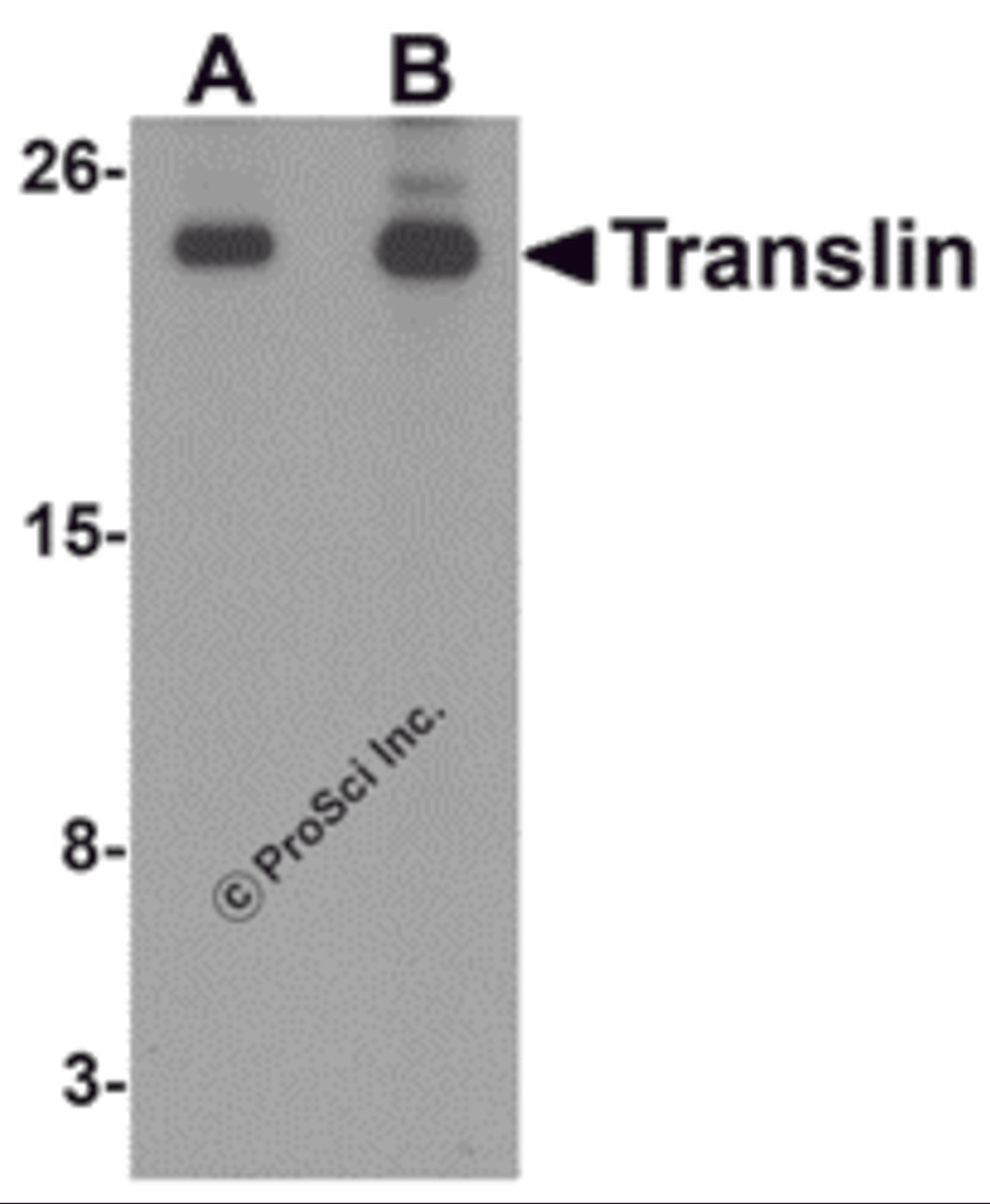 Western blot analysis of Translin in rat lung tissue lysate with Translin antibody at (A) 0.5 and (B) 1 μg/mL