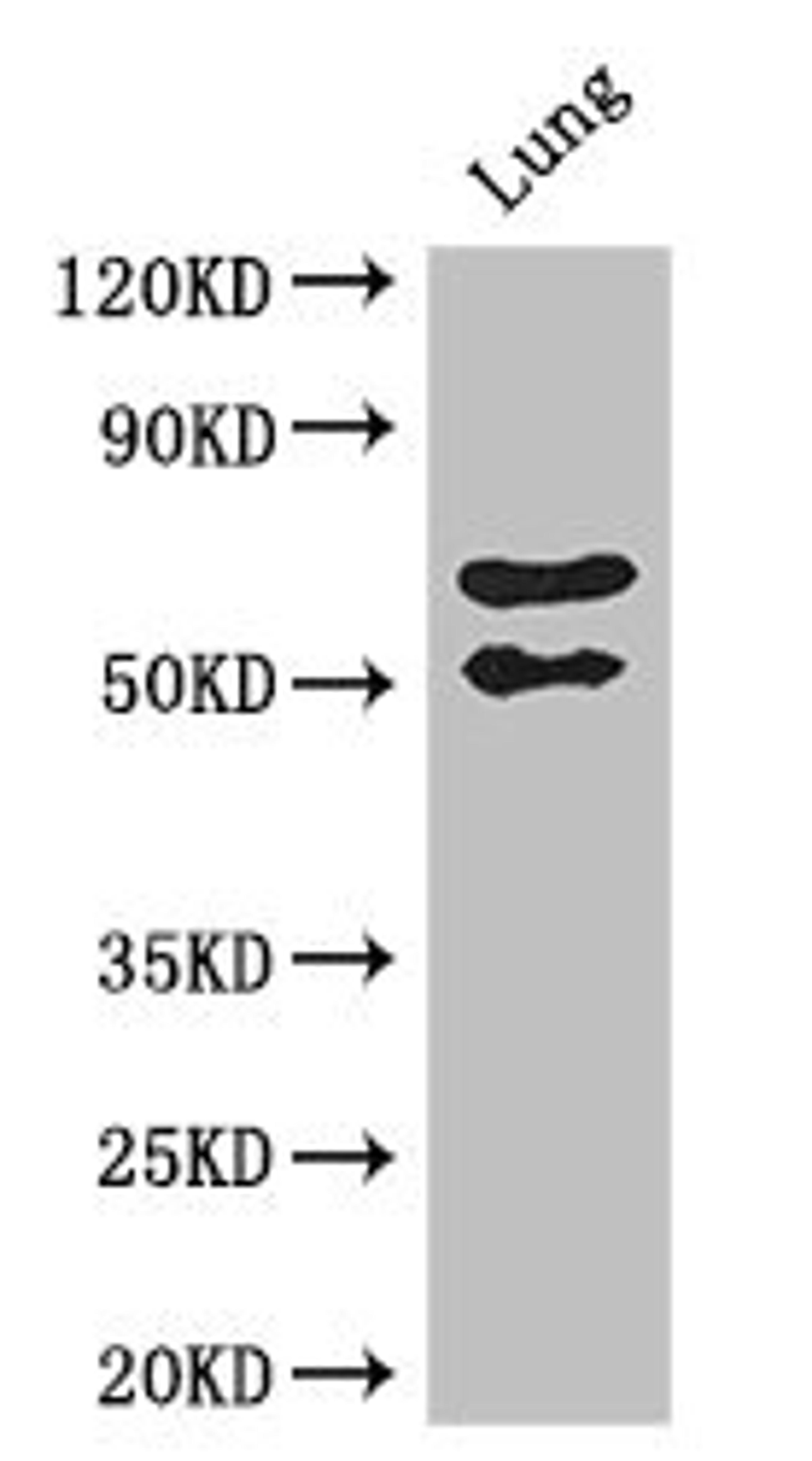 Western Blot. Positive WB detected in: Mouse lung tissue. All lanes: EFEMP2 antibody at 2.7ug/ml. Secondary. Goat polyclonal to rabbit IgG at 1/50000 dilution. Predicted band size: 50 kDa. Observed band size: 50, 70 kDa. 