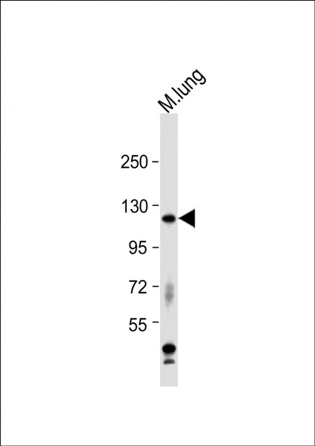 Western Blot at 1:1000 dilution + mouse lung lysate Lysates/proteins at 20 ug per lane.