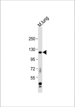 Western Blot at 1:1000 dilution + mouse lung lysate Lysates/proteins at 20 ug per lane.