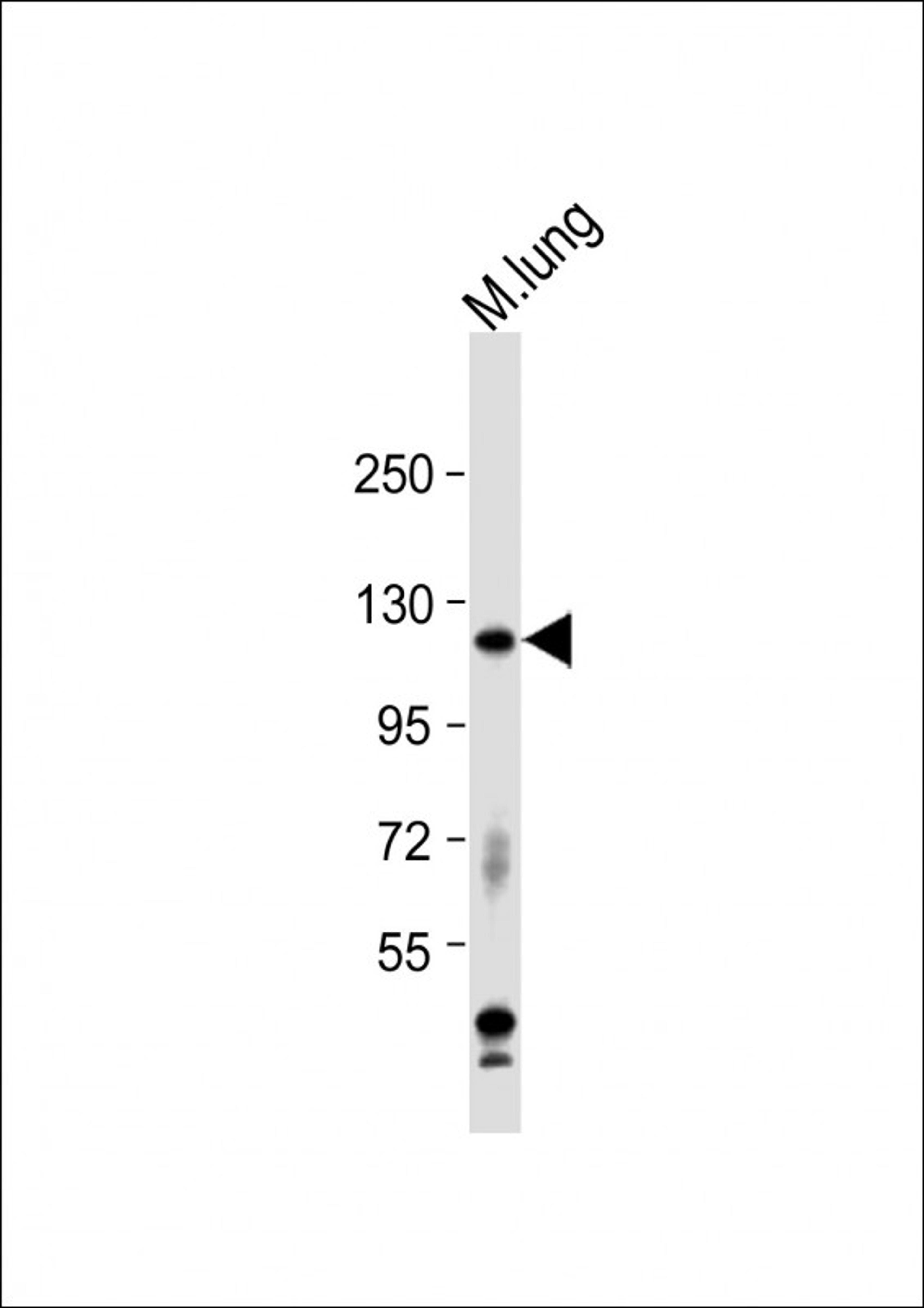 Western Blot at 1:1000 dilution + mouse lung lysate Lysates/proteins at 20 ug per lane.